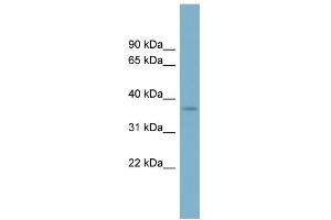WB Suggested Anti-SPAG4L Antibody Titration: 0. (SUN5 anticorps  (N-Term))