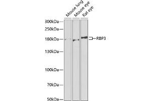 Western blot analysis of extracts of various cell lines, using RBP3 antibody (ABIN6129600, ABIN6146801, ABIN6146802 and ABIN6222034) at 1:1000 dilution. (RBP3 anticorps  (AA 18-320))
