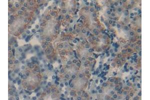 DAB staining on IHC-P; Samples: Mouse Kidney Tissue (CGA anticorps  (AA 25-120))