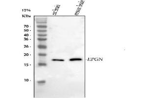 Western blot analysis of Epigen using anti-Epigen antibody (ABIN5518911). (Epigen anticorps  (AA 19-109))