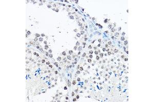 Immunohistochemistry of paraffin-embedded human colon using SP1 Rabbit pAb (ABIN7270506) at dilution of 1:50 (40x lens).