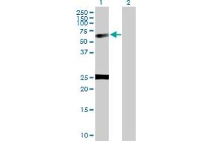Western Blot analysis of NUCB1 expression in transfected 293T cell line by NUCB1 MaxPab polyclonal antibody. (Nucleobindin 1 anticorps  (AA 1-461))