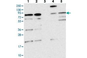 Western blot analysis of Lane 1: RT-4, Lane 2: U-251 MG, Lane 3: Human Plasma, Lane 4: Liver, Lane 5: Tonsil with KIAA1731 polyclonal antibody  at 1:250-1:500 dilution. (KIAA1731 (KIAA1731) anticorps)