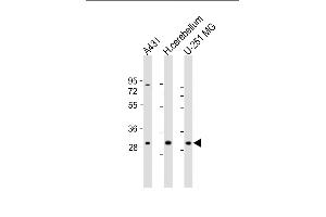 All lanes : Anti-BCDIN3D Antibody (C-Term) at 1:1000-2000 dilution Lane 1: A431 whole cell lysate Lane 2: human cerebellum lysate Lane 3: U-251 MG whole cell lysate Lysates/proteins at 20 μg per lane. (BCDIN3D anticorps  (AA 243-276))