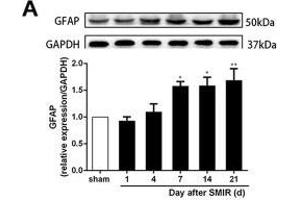 Astrocytes were activated and mainly expressed as the A1 phenotype in the spinal cord after SMIR. (GAPDH anticorps)