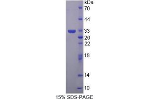 Image no. 1 for Glutaredoxin 3 (GLRX3) (AA 73-320) protein (His tag) (ABIN4990631)