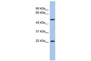 ANKH antibody used at 1 ug/ml to detect target protein. (ANKH anticorps)