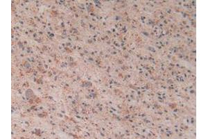 Figure. (Cytochrome C anticorps  (AA 5-100))