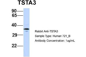 Host: Rabbit Target Name: TSTA3 Sample Type: 721_B Antibody Dilution: 1.
