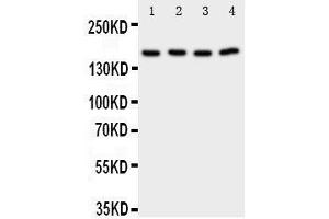 Anti-Phospholipase A2 antibody, Western blotting Lane 1: Rat Testis Tissue Lysate Lane 2: Rat Brain Tissue Lysate Lane 3: A549 Cell Lysate Lane 4: COLO320 Cell Lysate (PLA2G4A anticorps  (C-Term))