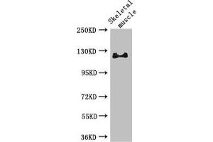Western Blot Positive WB detected in: Mouse skeletal muscle tissue All lanes: RBL1 antibody at 3 μg/mL Secondary Goat polyclonal to rabbit IgG at 1/50000 dilution Predicted band size: 121, 115 kDa Observed band size: 121 kDa (p107 anticorps  (AA 201-500))