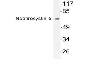Western blot (WB) analysis of Nephrocystin-5 antibody in extracts from K562 cells. (IQCB1 anticorps)