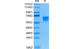Human B7-H4 on Tris-Bis PAGE under reduced condition.