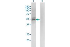Western Blot analysis of ACMSD expression in transfected 293T cell line by ACMSD monoclonal antibody (M01), clone 3A9. (ACMSD anticorps  (AA 179-278))