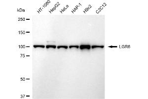 Western blotting analysis using LGR6 antibody (ABIN7799255).