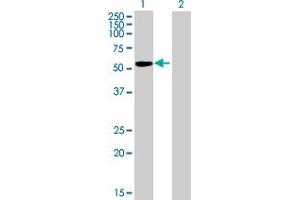 Western Blot analysis of IGSF21 expression in transfected 293T cell line by IGSF21 MaxPab polyclonal antibody. (IGSF21 anticorps  (AA 1-467))