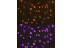 Immunofluorescence analysis of C6 cells using HMGB2 Rabbit mAb (ABIN7267649) at dilution of 1:100 (40x lens). (HMGB2 anticorps)