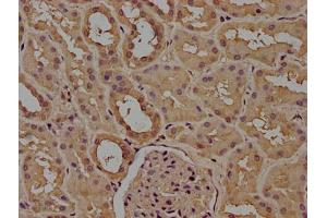IHC image of ABIN7160185 diluted at 1:100 and staining in paraffin-embedded human stomach tissue performed on a Leica BondTM system.