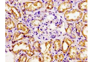 Immunohistochemistry of paraffin-embedded human kidney tissue using ABIN7161906 at dilution of 1:100 (NR2F6 anticorps  (AA 6-194))