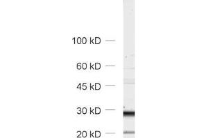 Western Blotting (WB) image for anti-Tumor Protein P63 Regulated 1-Like (TPRG1L) antibody (ABIN1742502)