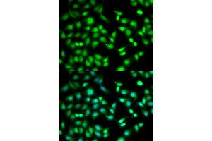 Immunofluorescence analysis of HeLa cells using CDKN2D antibody (ABIN5973935). (CDKN2D anticorps)