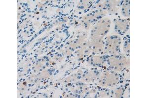 IHC-P analysis of stomach tissue, with DAB staining. (LOR anticorps  (AA 210-295))