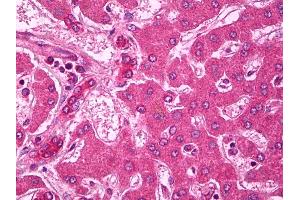 Anti-ABCA1 antibody IHC of human liver.