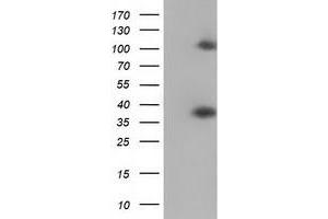 Western Blotting (WB) image for anti-Zinc Finger Protein 36, C3H Type, Homolog (Mouse) (ZFP36) antibody (ABIN1501404) (ZFP36 anticorps)