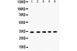 Anti- EBAG9 Picoband antibody, Western blottingAll lanes: Anti EBAG9  at 0.