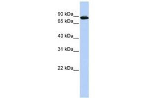 Image no. 1 for anti-HIV-1 Tat Specific Factor 1 (HTATSF1) (AA 612-661) antibody (ABIN6744230) (HTATSF1 anticorps  (AA 612-661))