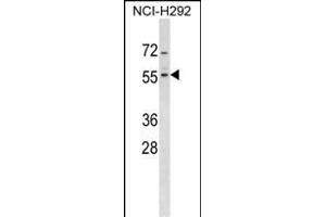 ZN Antibody (Center) (ABIN1537992 and ABIN2849203) western blot analysis in NCI- cell line lysates (35 μg/lane). (ZNF200 anticorps  (AA 187-214))