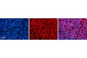 Rabbit Anti-TANK Antibody   Formalin Fixed Paraffin Embedded Tissue: Human Liver Tissue Observed Staining: Cytoplasm in hepatocytes Primary Antibody Concentration: N/A Other Working Concentrations: 1:600 Secondary Antibody: Donkey anti-Rabbit-Cy3 Secondary Antibody Concentration: 1:200 Magnification: 20X Exposure Time: 0.