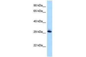 Image no. 1 for anti-RAB33B, Member RAS Oncogene Family (RAB33B) (AA 80-129) antibody (ABIN6747936) (RAB33B anticorps  (AA 80-129))