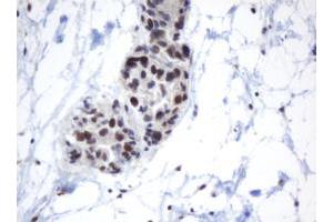 Image no. 1 for anti-Methyltransferase Like 16 (METTL16) antibody (ABIN1499432)