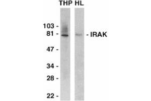 Image no. 1 for anti-Interleukin-1 Receptor-Associated Kinase 1 (IRAK1) (C-Term) antibody (ABIN201163) (IRAK1 anticorps  (C-Term))