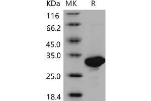 Western Blotting (WB) image for Carbonic Anhydrase II (CA2) (Active) protein (His tag) (ABIN7194562)