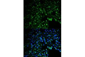 Immunofluorescence analysis of HeLa cells using UGDH antibody. (UGDH anticorps  (AA 165-494))