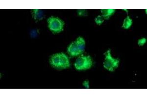Image no. 3 for anti-Spastic Paraplegia 7 (SPG7) (AA 300-573) antibody (ABIN1491371)