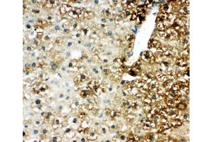 Anti-IRAKM antibody,  IHC(P) IHC(P): Mouse Liver Tissue