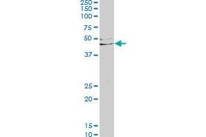 LEFTY1 monoclonal antibody (M03), clone 2E10.