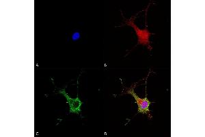 Immunocytochemistry/Immunofluorescence analysis using Mouse Anti-Alpha-2C Adrenergic Receptor Monoclonal Antibody, Clone S330A-80 (ABIN2485209).