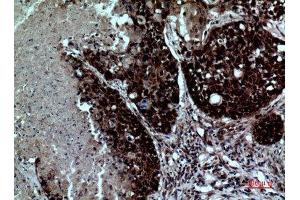Immunohistochemistry (IHC) analysis of paraffin-embedded Human Lung, antibody was diluted at 1:100.