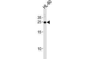 Western Blotting (WB) image for anti-Homeobox A6 (HOXA6) antibody (ABIN2996495) (HOXA6 anticorps)