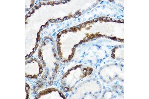 Immunohistochemistry of paraffin-embedded rat kidney using OAT Rabbit pAb (ABIN6127442, ABIN6144985, ABIN6144986 and ABIN6221831) at dilution of 1:150 (40x lens). (OAT anticorps  (AA 160-439))