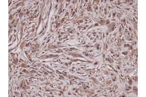 IHC-P Image Immunohistochemical analysis of paraffin-embedded U373 xenograft, using GRAP, antibody at 1:100 dilution.