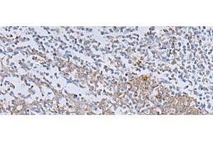 Immunohistochemistry of paraffin-embedded Human tonsil tissue using IL22RA2 Polyclonal Antibody at dilution of 1:70(x200)