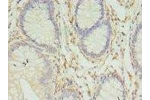 Immunohistochemistry (IHC) image for anti-Major Histocompatibility Complex, Class II, DR beta 4 (HLA-DRB4) (AA 30-227) antibody (ABIN6060855) (HLA-DRB4 anticorps  (AA 30-227))