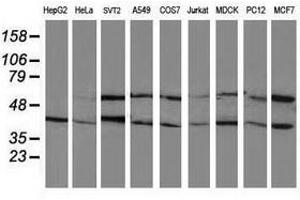 Image no. 2 for anti-Protein Phosphatase, Mg2+/Mn2+ Dependent, 1B (PPM1B) antibody (ABIN1500376)