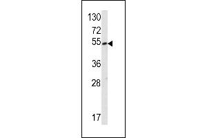 SUV420H2/KMT5C anticorps  (AA 187-214)
