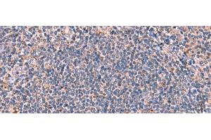 Immunohistochemistry of paraffin-embedded Human tonsil tissue using FDXR Polyclonal Antibody at dilution of 1:85(x200) (Ferredoxin Reductase anticorps)